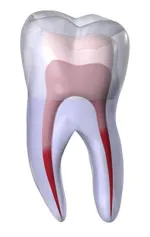 Transparent model of a tooth